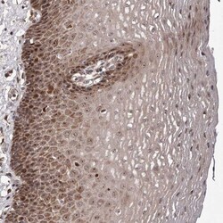ZCCHC7 Antibody, Novus Biologicals 0.1mL; Unlabeled:Antibodies, Polyclonal