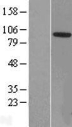 Novus Biologicals™ ZCCHC8 Overexpression Lysate