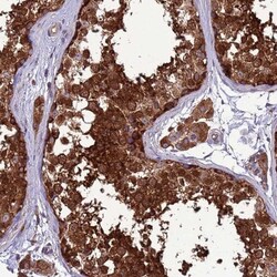 ZCCHV Antibody, Novus Biologicals 0.1mL; Unlabeled:Antibodies, Polyclonal
