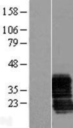 Novus Biologicals™ ZCRB1 Overexpression Lysate