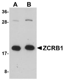 ZCRB1 Antibody - BSA Free, Novus Biologicals 0.025 mg, Unconjugated:Antibodies,
