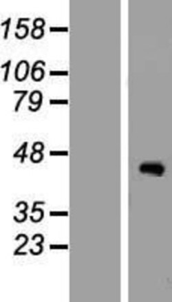 Novus Biologicals&trade;&nbsp;ZCWPW2 Overexpression Lysate