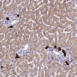 ZDHHC1 Antibody, Novus Biologicals:Antibodies:Primary Antibodies