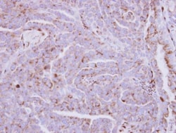 ZDHHC11 Antibody, Novus Biologicals 0.1mL; Unlabeled:Antibodies