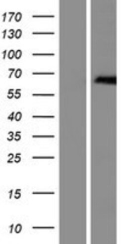 Novus Biologicals&trade;&nbsp;ZDHHC13 Overexpression Lysate