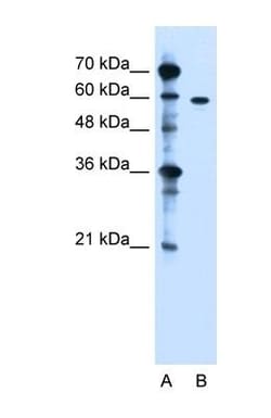 ZDHHC13 Antibody, Novus Biologicals:Antibodies:Primary Antibodies