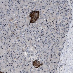 ZDHHC15 Antibody, Novus Biologicals 25 &mu;L | Buy Online | Novus Biologicals | Fisher Scientific