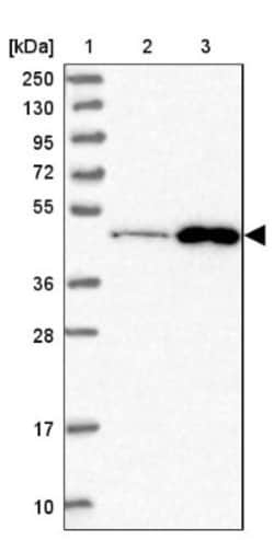ZDHHC16 Antibody, Novus Biologicals:Antibodies:Primary Antibodies
