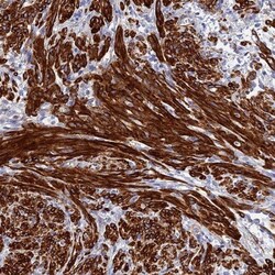 ZDHHC16 Antibody, Novus Biologicals:Antibodies:Primary Antibodies