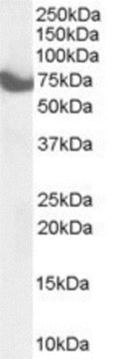 ZDHHC17 Antibody, Novus Biologicals 0.1mg; Unlabeled:Antibodies, Polyclonal
