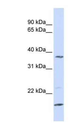 ZDHHC19 Antibody, Novus Biologicals 100 &mu;L | Buy Online | Novus Biologicals | Fisher Scientific
