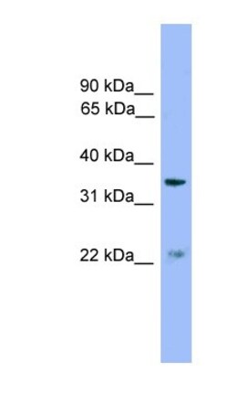 ZDHHC21 Antibody, Novus Biologicals:Antibodies:Primary Antibodies