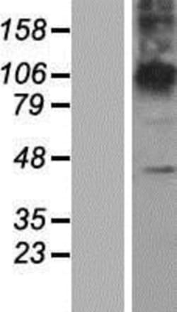 Novus Biologicals&trade;&nbsp;ZDHHC23 Overexpression Lysate