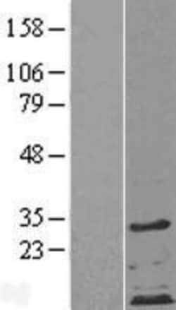 Novus Biologicals&trade;&nbsp;ZDHHC4 Overexpression Lysate