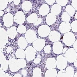 ZDHHC7 Antibody, Novus Biologicals:Antibodies:Primary Antibodies