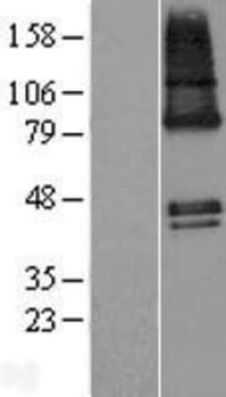 Novus Biologicals™ ZDHHC9 Overexpression Lysate