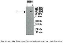 ZEB1 Antibody, Novus Biologicals 100&mu;L; Unlabeled:Antibodies, Polyclonal
