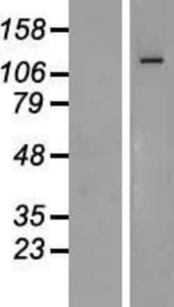 Novus Biologicals&trade;&nbsp;ZEB1 Overexpression Lysate