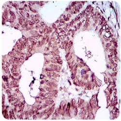 ZEB1 Antibody (2A8A6) - BSA Free, Novus Biologicals 0.025mL; Unlabeled:Antibodies,