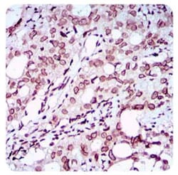 ZEB1 Antibody (2A8A6) - BSA Free, Novus Biologicals 0.025mL; Unlabeled:Antibodies,