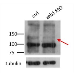 ZEB1 Antibody, Novus Biologicals 100&mu;L; Unlabeled:Antibodies, Polyclonal