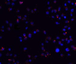 ZEB2 Antibody - BSA Free, Novus Biologicals 0.1mg; Unlabeled:Antibodies,