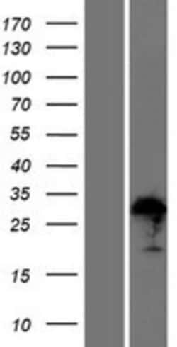 Novus Biologicals&trade;&nbsp;ZFAND1 Overexpression Lysate