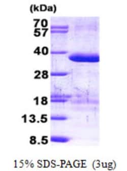 Novus Biologicals&trade;&nbsp;Recombinant Human ZFAND1 His Protein
