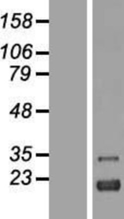 Novus Biologicals&trade;&nbsp;ZFAND2A Overexpression Lysate
