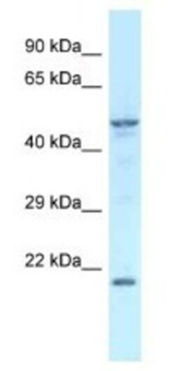 Zfp113 Antibody, Novus Biologicals 100&mu;L; Unlabeled:Antibodies, Polyclonal