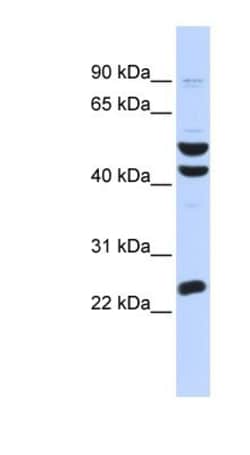 ZFP200 Antibody, Novus Biologicals 100&mu;L; Unlabeled:Antibodies, Polyclonal