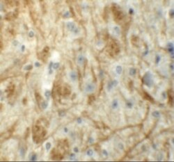 Zfp219 Antibody - BSA Free, Novus Biologicals 0.1mg; Unlabeled:Antibodies,