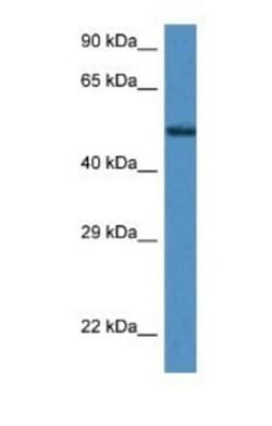 Zfp275 Antibody, Novus Biologicals:Antibodies:Primary Antibodies