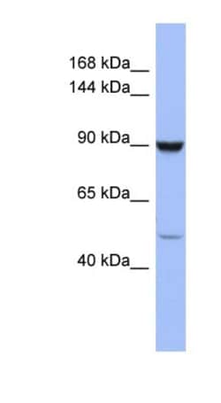 ZFP28 Antibody, Novus Biologicals 100 &mu;L | Buy Online | Novus Biologicals | Fisher Scientific