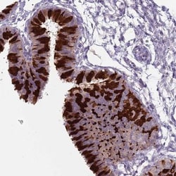 ZFP2 Antibody, Novus Biologicals 25 &mu;L, Unlabeled:Antibodies, Polyclonal
