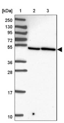 ZFP3 Antibody, Novus Biologicals 0.1mL; Unlabeled:Antibodies, Polyclonal