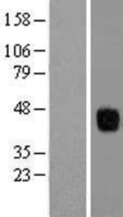 Novus Biologicals&trade;&nbsp;ZFP36L1 Overexpression Lysate