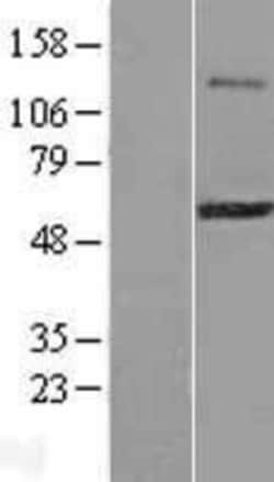 Novus Biologicals™ ZSCAN21/ZFP38 Overexpression Lysate
