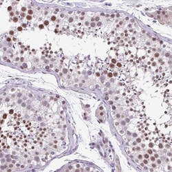 ZFP3 Antibody, Novus Biologicals 0.1mL; Unlabeled:Antibodies, Polyclonal