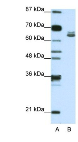 ZFP57 Antibody, Novus Biologicals 0.1mg; Unlabeled:Antibodies, Polyclonal