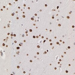 ZFP92 Antibody, Novus Biologicals:Antibodies:Primary Antibodies