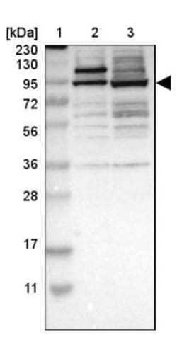 ZFP95 Antibody, Novus Biologicals 0.1mL; Unlabeled:Antibodies, Polyclonal