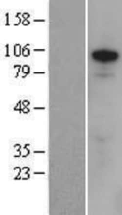 Novus Biologicals&trade;&nbsp;ZFX Overexpression Lysate