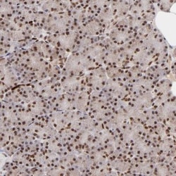 ZFX Antibody, Novus Biologicals 0.1mL; Unlabeled:Antibodies, Polyclonal