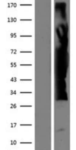 Novus Biologicals&trade;&nbsp;ZFYVE19 Overexpression Lysate