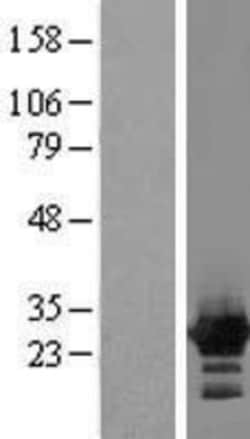 Novus Biologicals™ ZFYVE21 Overexpression Lysate
