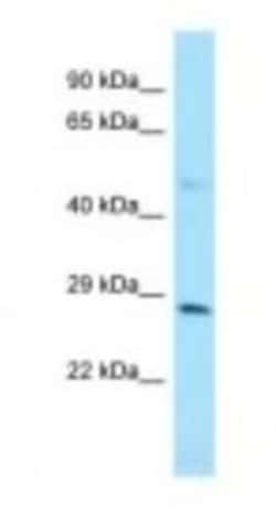 ZFYVE21 Antibody, Novus Biologicals:Antibodies:Primary Antibodies