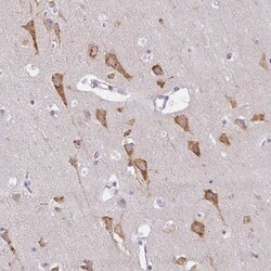 ZFYVE26 Antibody, Novus Biologicals 25 &mu;L, Unlabeled:Antibodies, Polyclonal