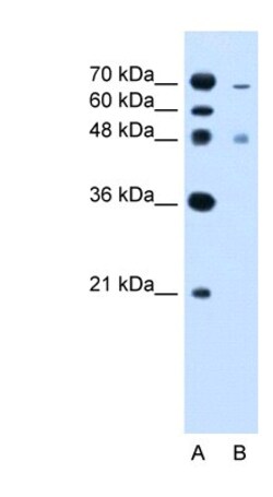 ZFYVE27 Antibody, Novus Biologicals 100&mu;L; Unlabeled:Antibodies, Polyclonal