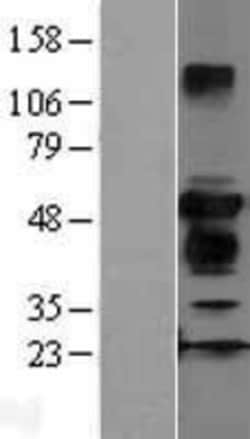 Novus Biologicals&trade;&nbsp;ZFYVE27 Overexpression Lysate